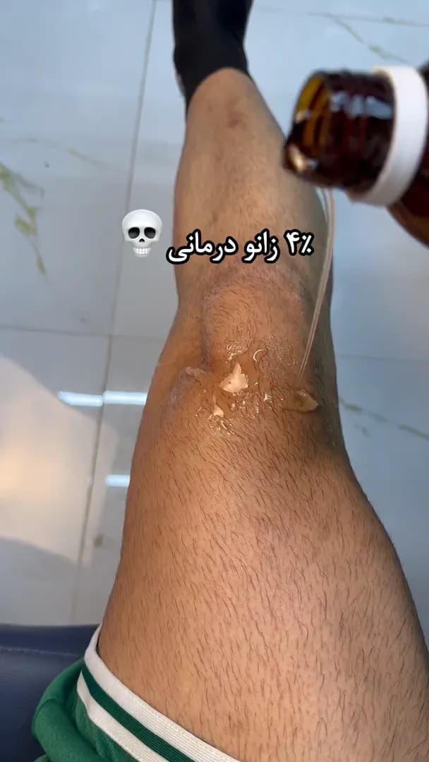 ماساژور زانو MDHL MD-9860 | گرمایش، ماساژ لرزشی و بالشتک هوا